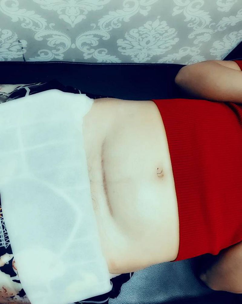 刀口遮盖纹身图片_腹部水彩纹身图案