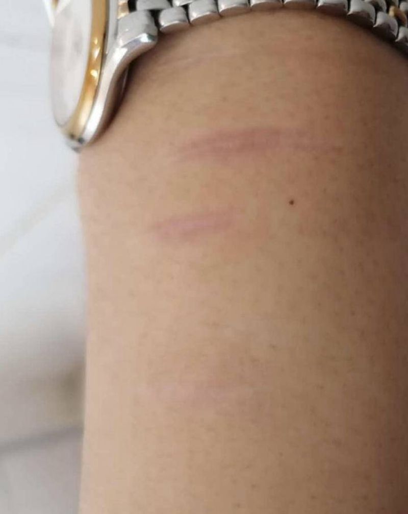 疤痕遮盖纹身图片_手臂手部水彩纹身图案