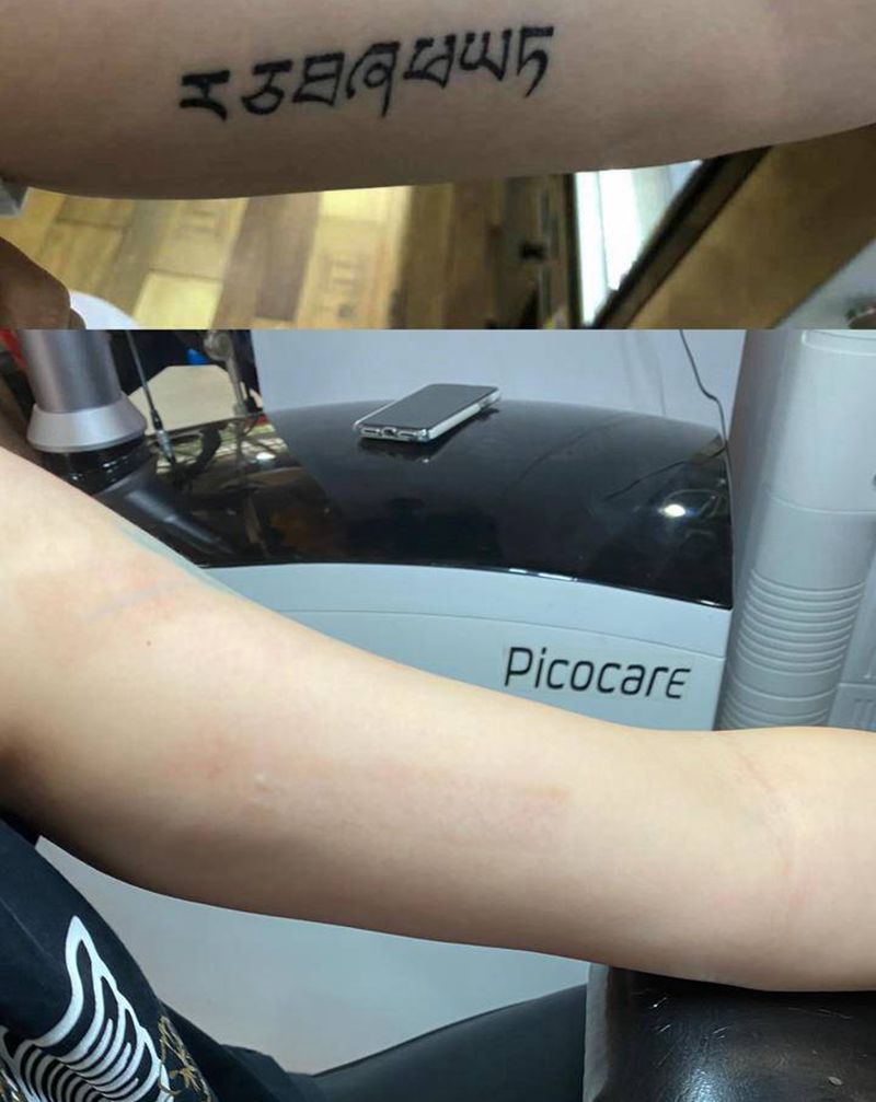 洗纹身纹身图片_手臂纹身图案