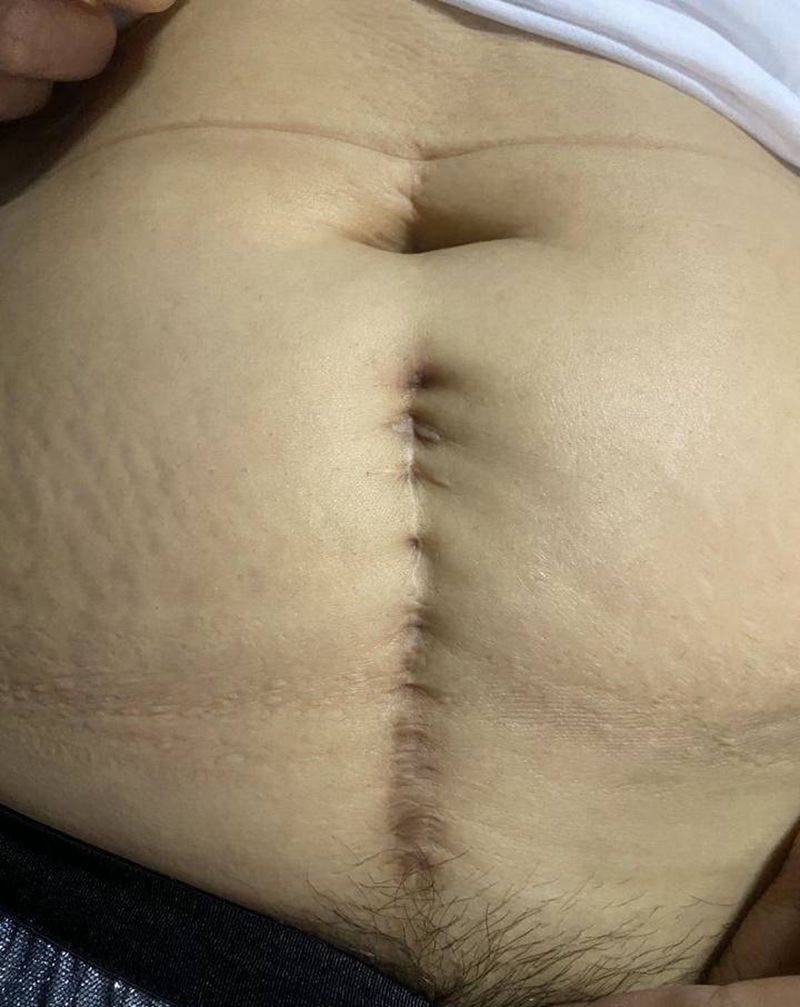 荷花遮盖纹身图片_腹部纹身图案