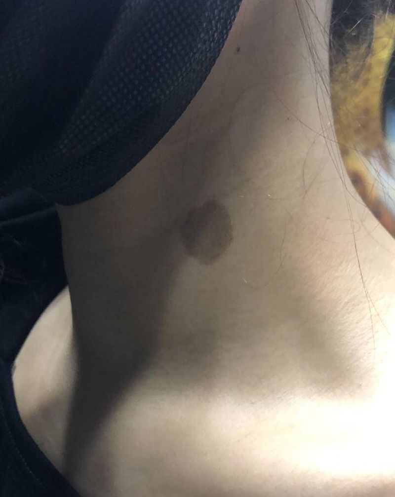 遮盖胎记纹身图片_遮盖脖子向日葵纹身图案