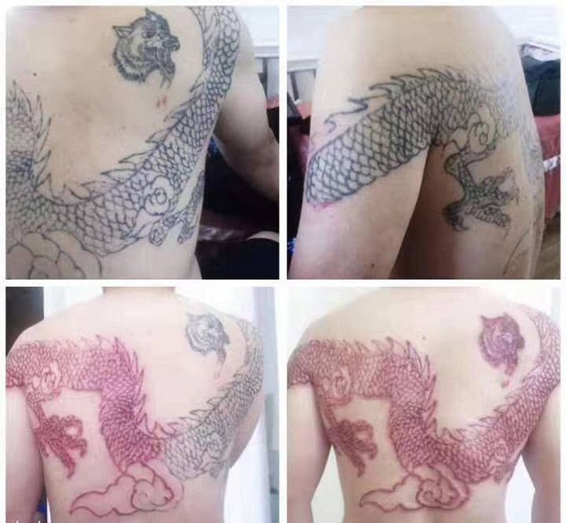 皮秒清洗纹身图片_背部新传统纹身图案