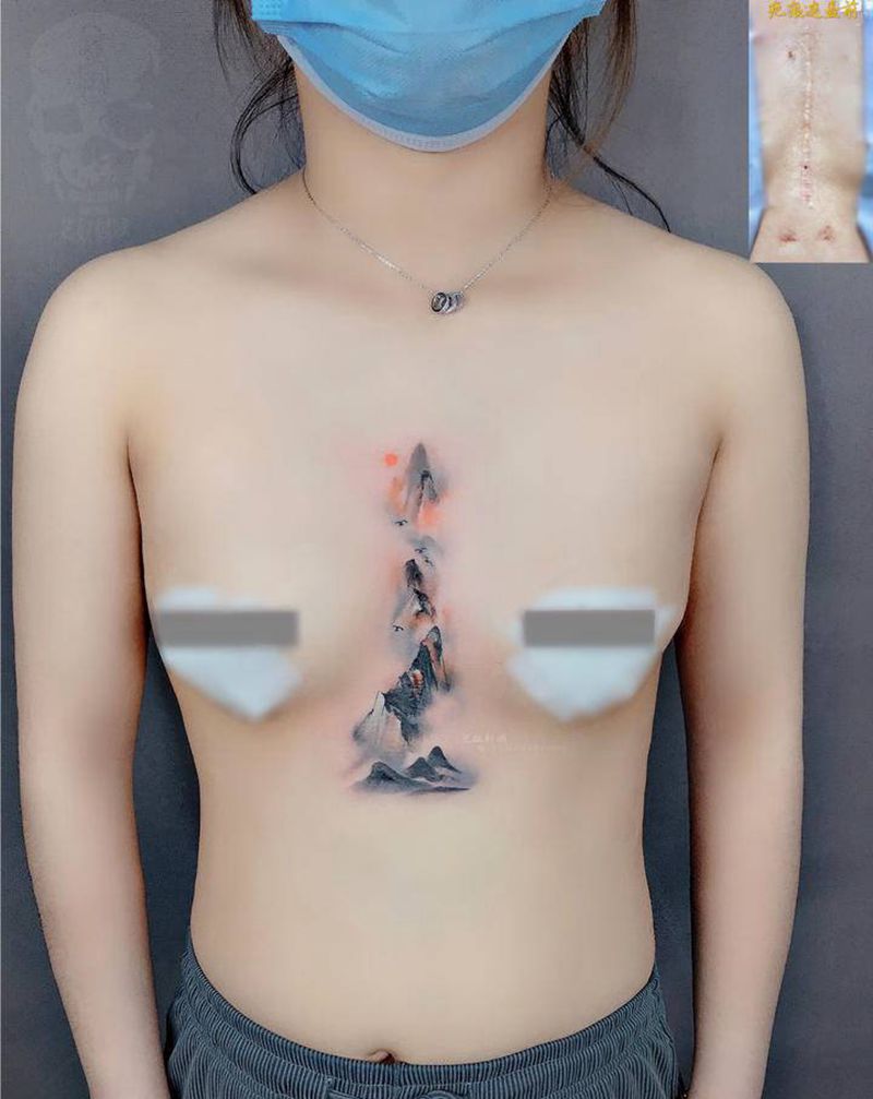 疤痕遮盖纹身图片_胸部腹部水墨疤痕遮盖纹身图案