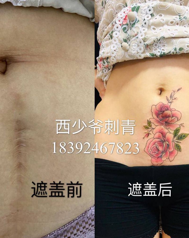 剖腹产遮盖遮盖花纹身图片_腹部新传统纹身图案