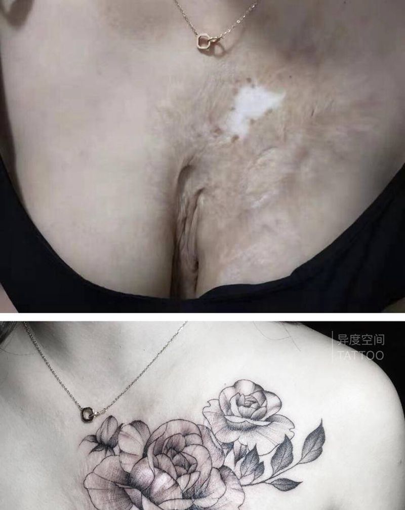 素花纹身图片_胸部背部点刺小清新遮盖疤痕纹身图案