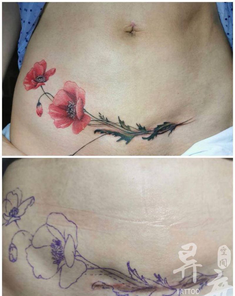 疤痕遮盖纹身图片_腹部水墨水彩罂粟纹身图案