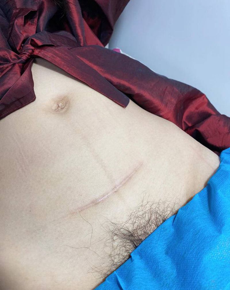 疤痕遮盖纹身图片_腹部纹身图案