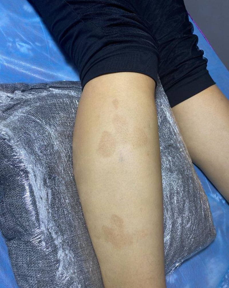 胎记遮盖纹身图片_腿部纹身图案