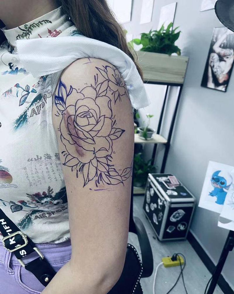 疤痕遮盖纹身图片_手臂纹身图案