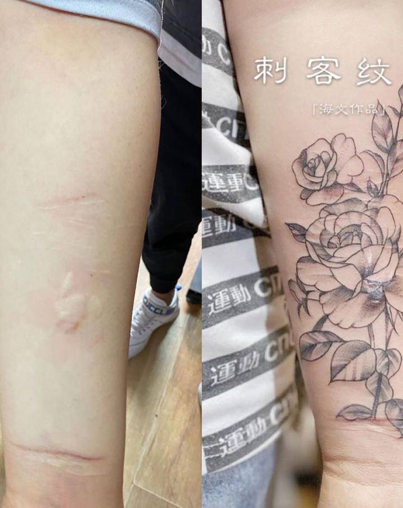 疤痕遮盖纹身图片_手臂纹身图案