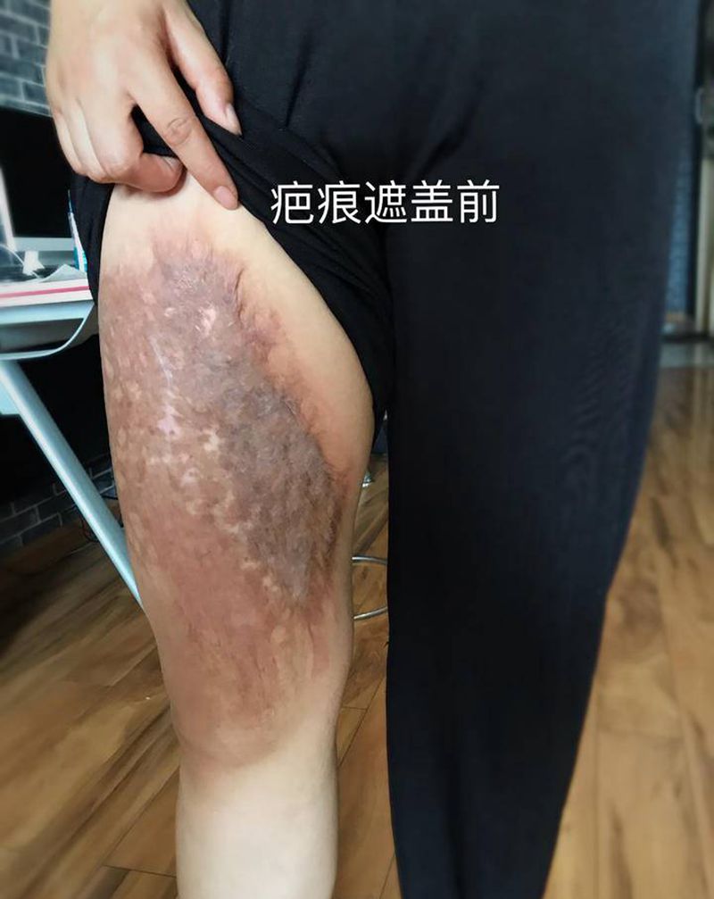 覆盖疤痕纹身图片_腿部新传统纹身图案