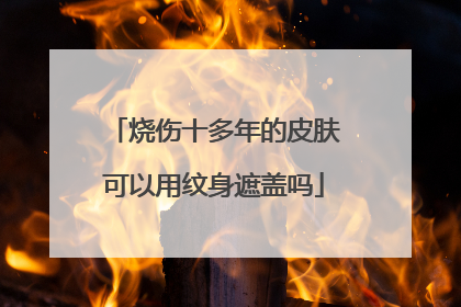 烧伤十多年的皮肤可以用纹身遮盖吗