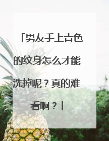 男友手上青色的纹身怎么才能洗掉呢?真的难看啊?