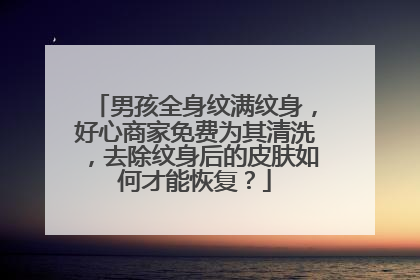 男孩全身纹满纹身,好心商家免费为其清洗,去除纹身后的皮肤如何才能恢复?