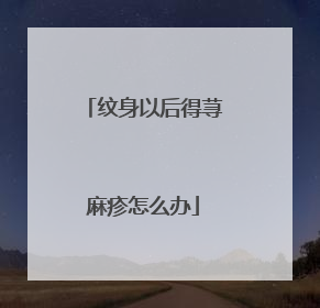 纹身以后得荨麻疹怎么办