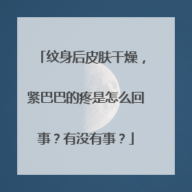 纹身后皮肤干燥，紧巴巴的疼是怎么回事？有没有事？