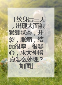 纹身后三天，出现大面积紧绷状态，开裂，胀痛，结痂很厚，很恶心，求大神指点怎么处理？如图