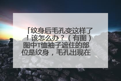 纹身后毛孔变这样了！该怎么办？（有图）图中T恤袖子遮住的部位是纹身，毛孔出现在纹身的下部。