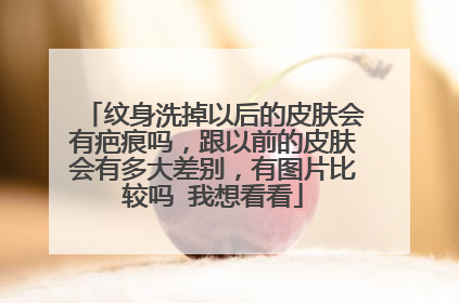 纹身洗掉以后的皮肤会有疤痕吗，跟以前的皮肤会有多大差别，有图片比较吗 我想看看
