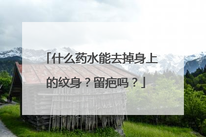 什么药水能去掉身上的纹身？留疤吗？