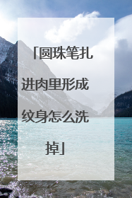 圆珠笔扎进肉里形成纹身怎么洗掉
