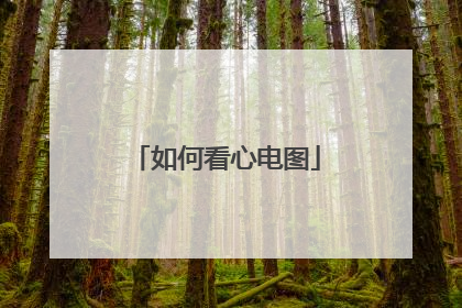 如何看心电图