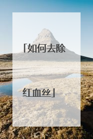 如何去除红血丝