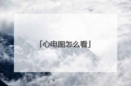 心电图怎么看