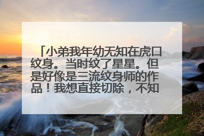 小弟我年幼无知在虎口纹身。当时纹了星星。但是好像是三流纹身师的作品！我想直接切除，不知这个办法可行