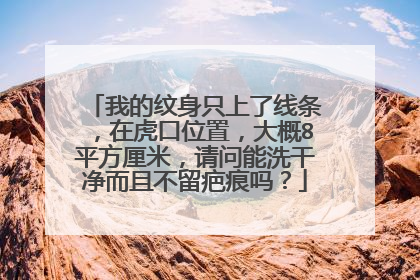 我的纹身只上了线条，在虎口位置，大概8平方厘米，请问能洗干净而且不留疤痕吗？