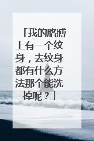 我的胳膊上有一个纹身，去纹身都有什么方法那个能洗掉呢？