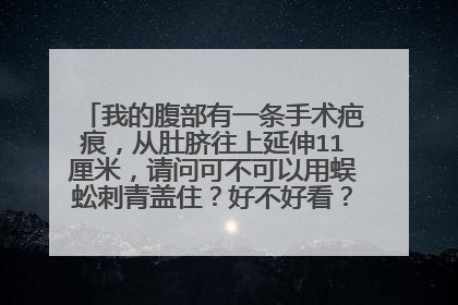 我的腹部有一条手术疤痕,从肚脐往上延伸11厘米,请问可不可以用蜈蚣刺青盖住?好不好看?大约多少钱呢?