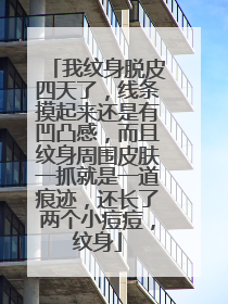 我纹身脱皮四天了，线条摸起来还是有凹凸感，而且纹身周围皮肤一抓就是一道痕迹，还长了两个小痘痘，纹身