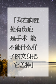 我右脚踝处有伤疤 是手术 能不能什么样子的文身把它盖掉