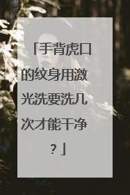 手背虎口的纹身用激光洗要洗几次才能干净？