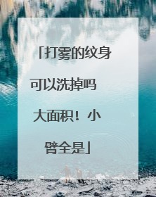 打雾的纹身可以洗掉吗 大面积! 小臂全是