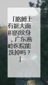 胳膊上有挺大面积的纹身，广东燕岭医院能洗掉吗？