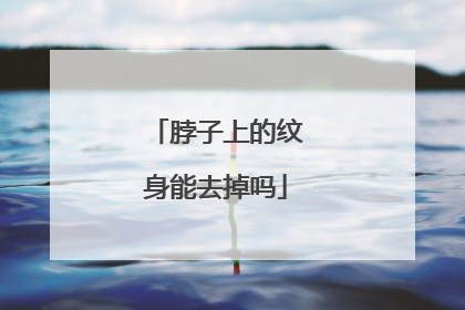 脖子上的纹身能去掉吗