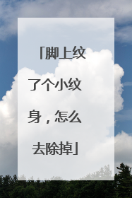 脚上纹了个小纹身,怎么去除掉