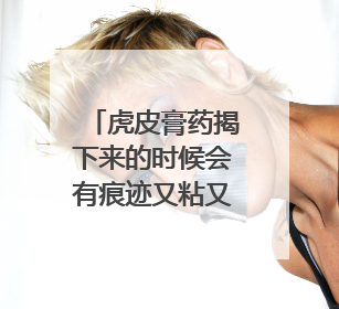 虎皮膏药揭下来的时候会有痕迹又粘又白求去掉的方法