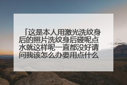 这是本人用激光洗纹身后的照片洗纹身后碰呢点水就这样呢一直都没好请问我该怎么办要用点什么药让它恢复谢